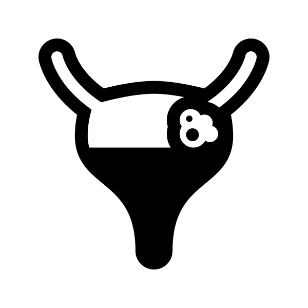Bladder Cancer