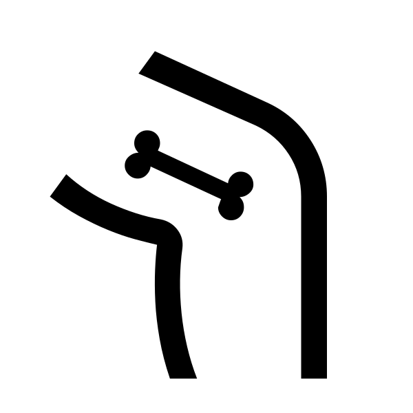 Femur Alt