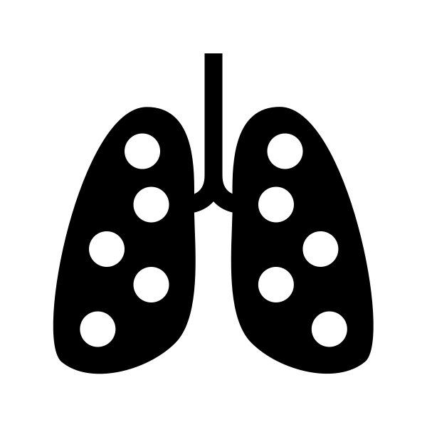 Pneumonia