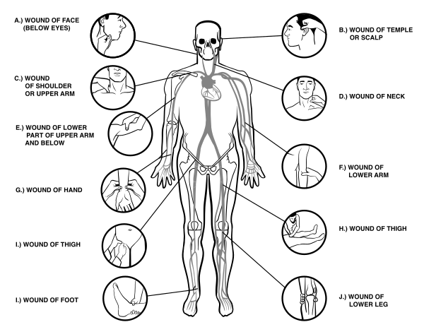 Pressure Points