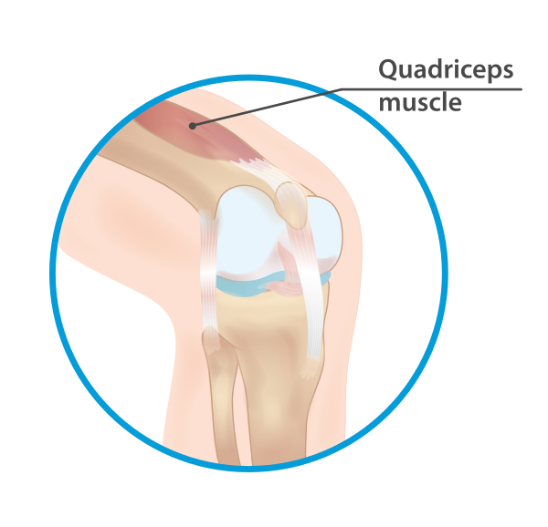 Quadriceps Muscle