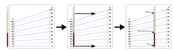 Reading Spun Hematocrit