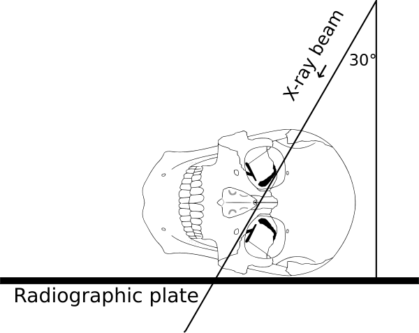 Schuller's View