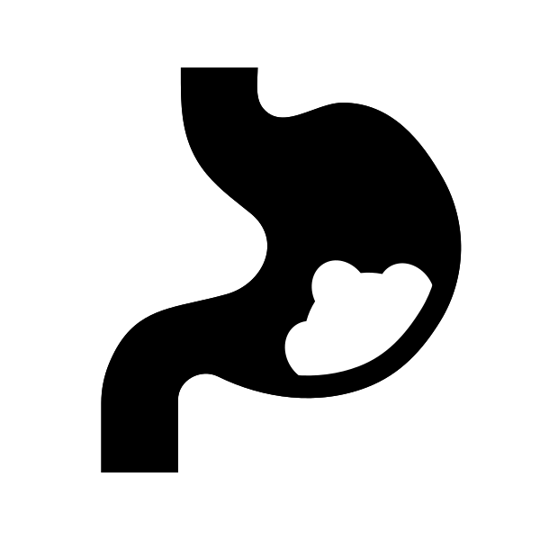Stomach Cancer