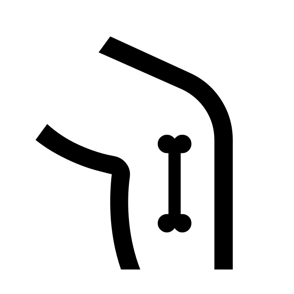 Tibia Alt