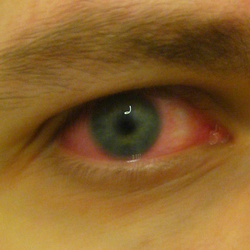 Red Horror Eye
