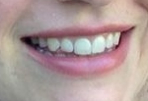 Smile #2