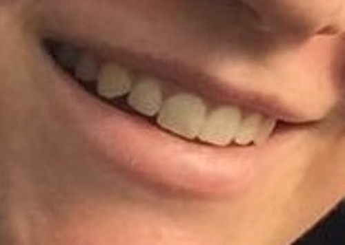 Smile 3