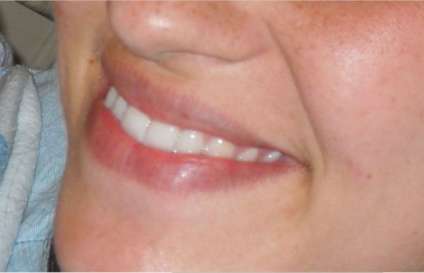 Smile 4