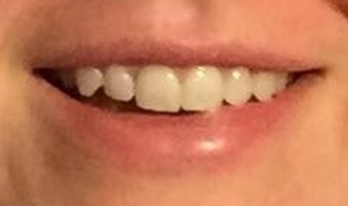 Smile 5