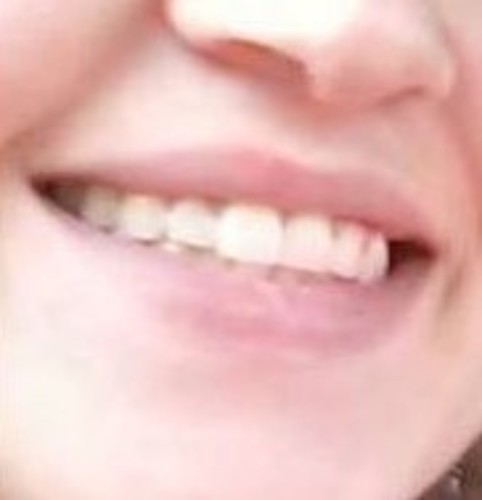 Smile